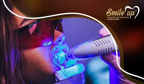 تبييض الأسنان