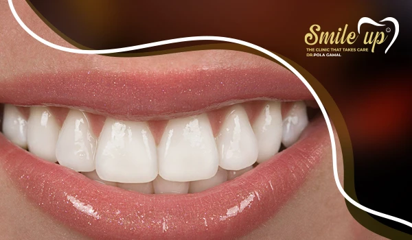 إبتسامة هوليود