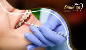 تقويم الأسنان