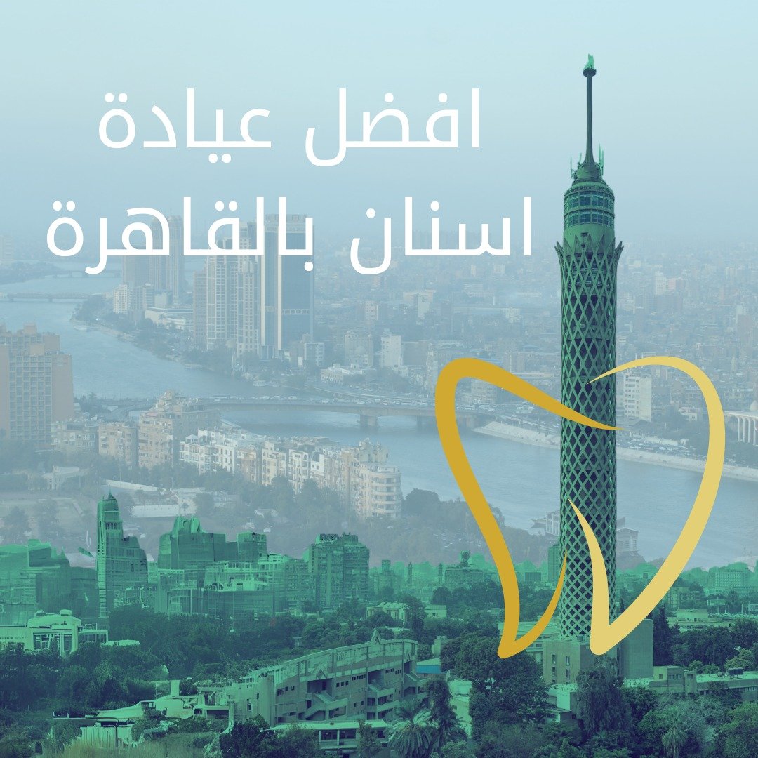 تركيب اسنان تعرف أهم 8 أسباب لاختيارك عيادة تركيب اسنان بالقاهرة