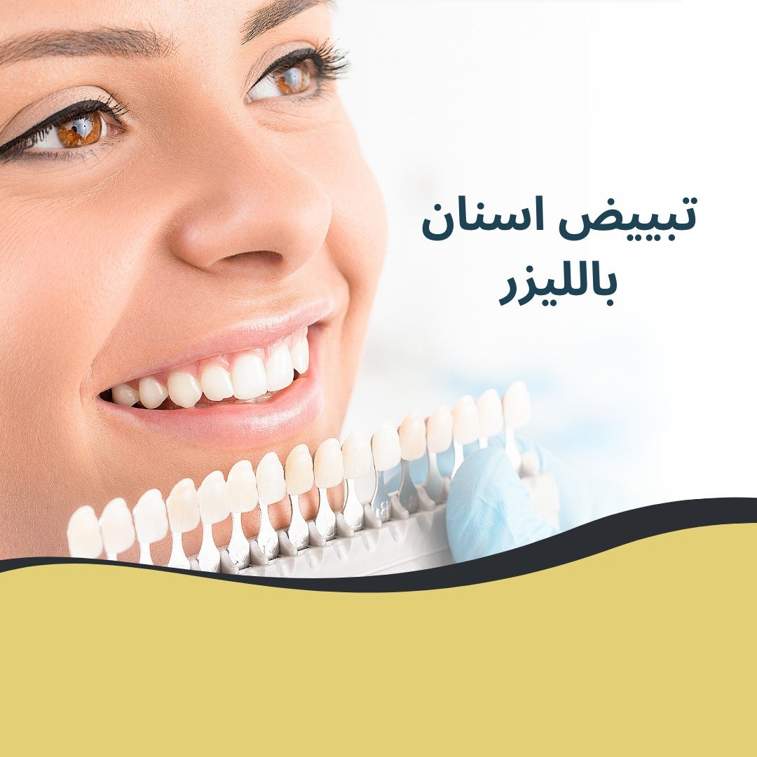 افضل عيادة تبييض الاسنان بالليزر بالقاهرة