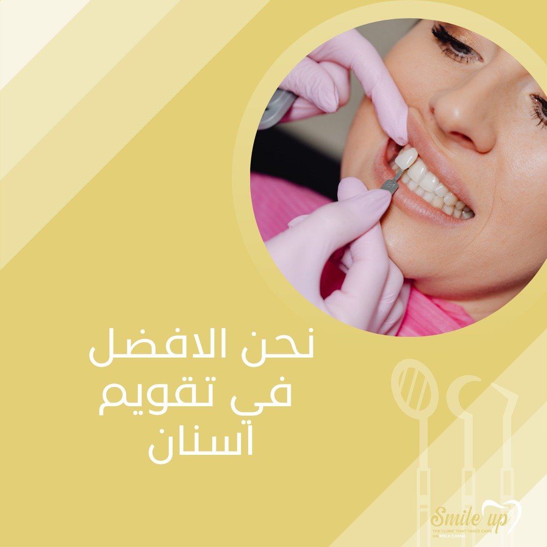 تقويم اسنان