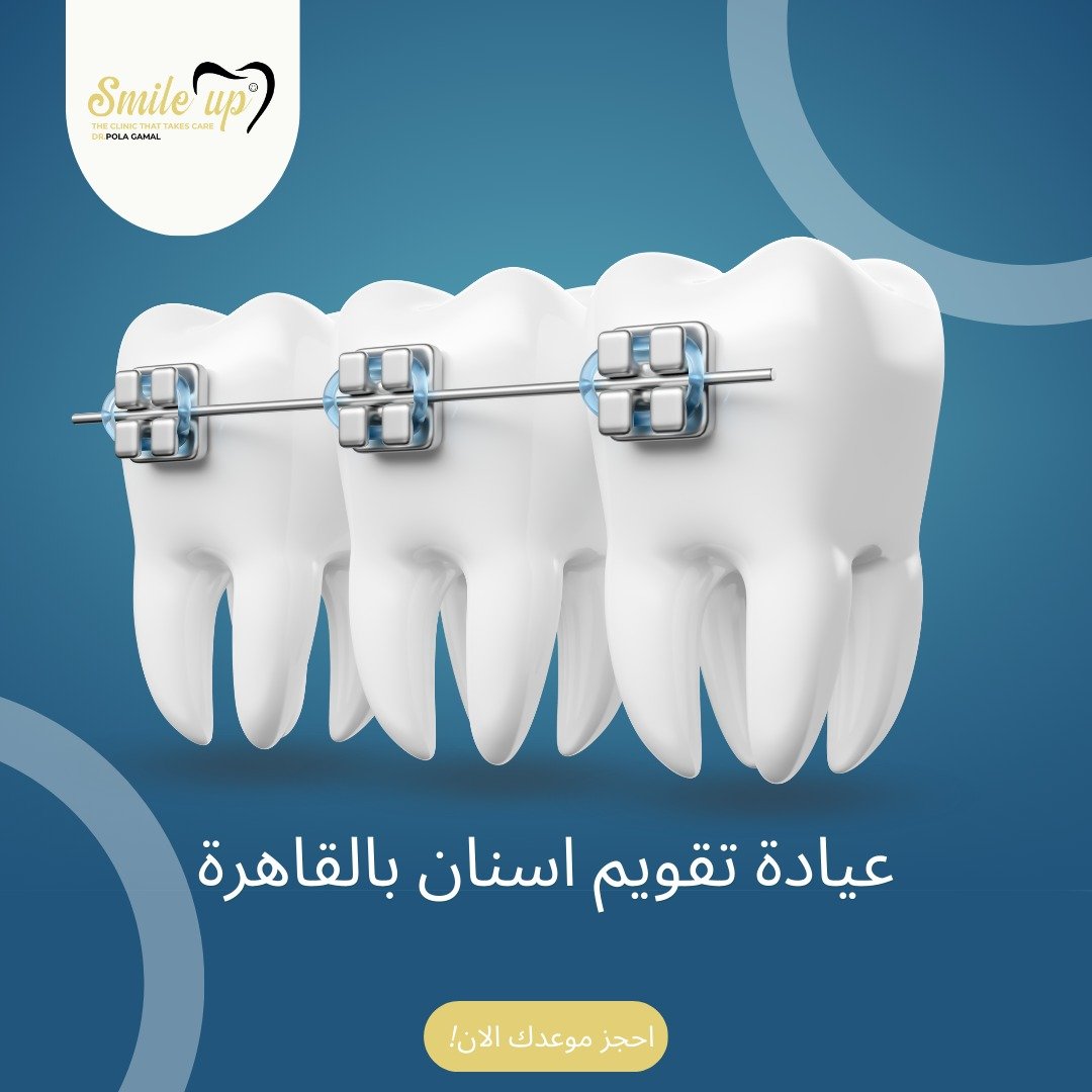 افضل عيادة تقويم اسنان بالقاهرة 2025