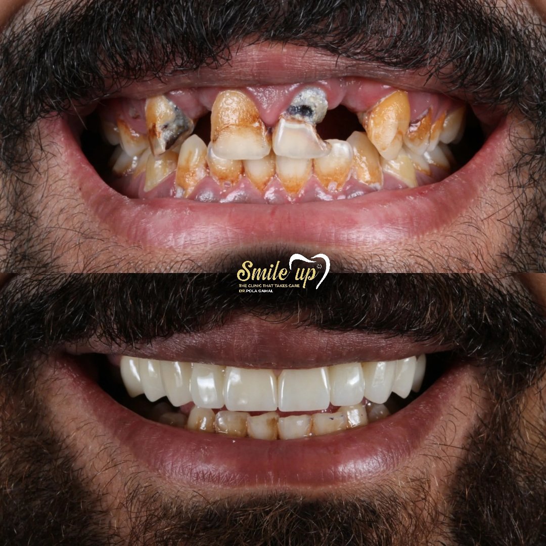 Your paragraph text_20241022_155601_0015