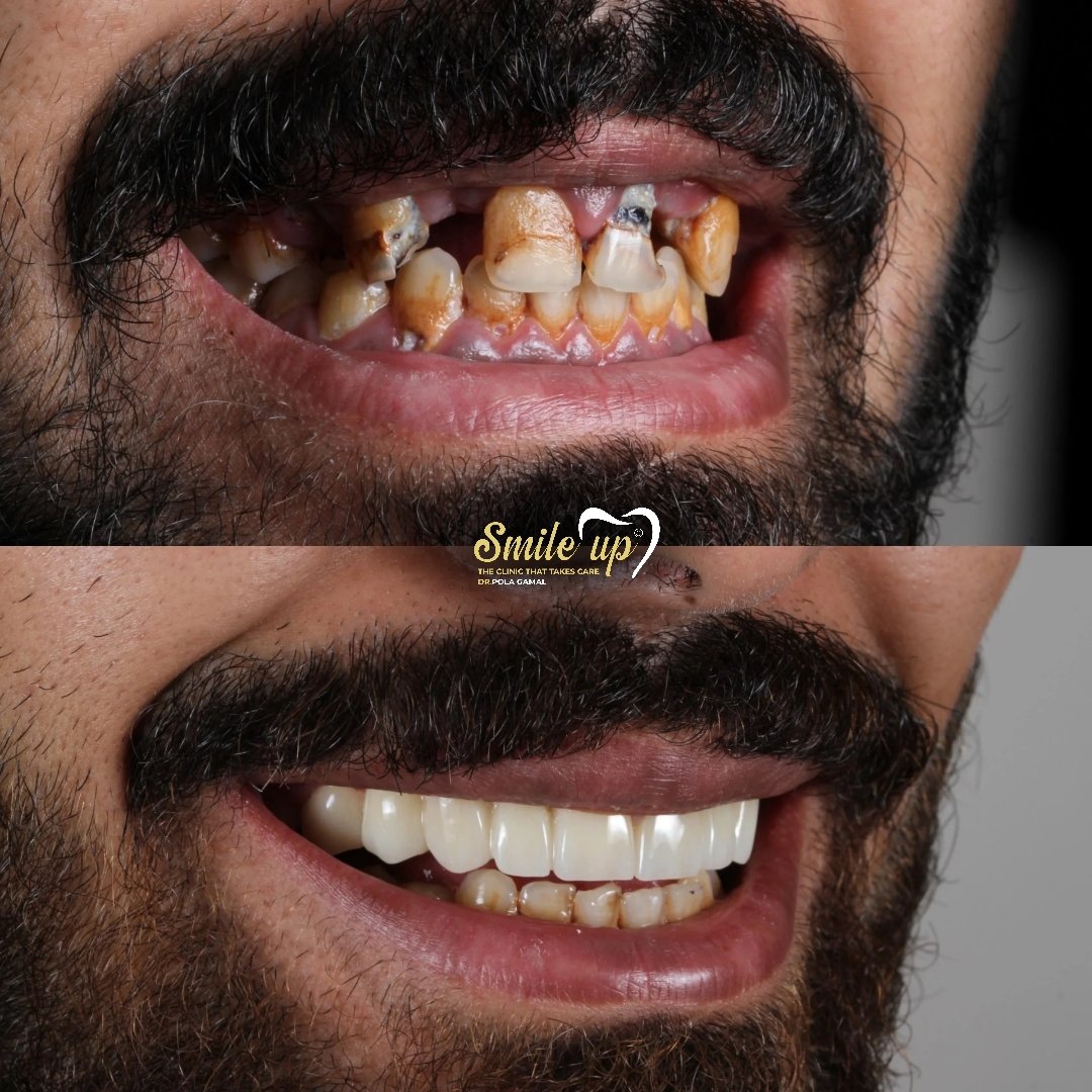 Your paragraph text_20241022_155602_0016