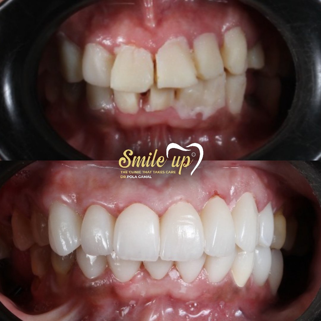 Your paragraph text_20241022_155602_0019