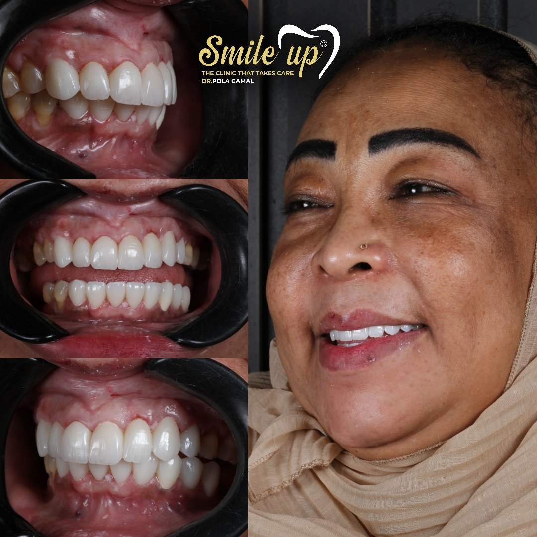 Your paragraph text_20241022_155603_0023