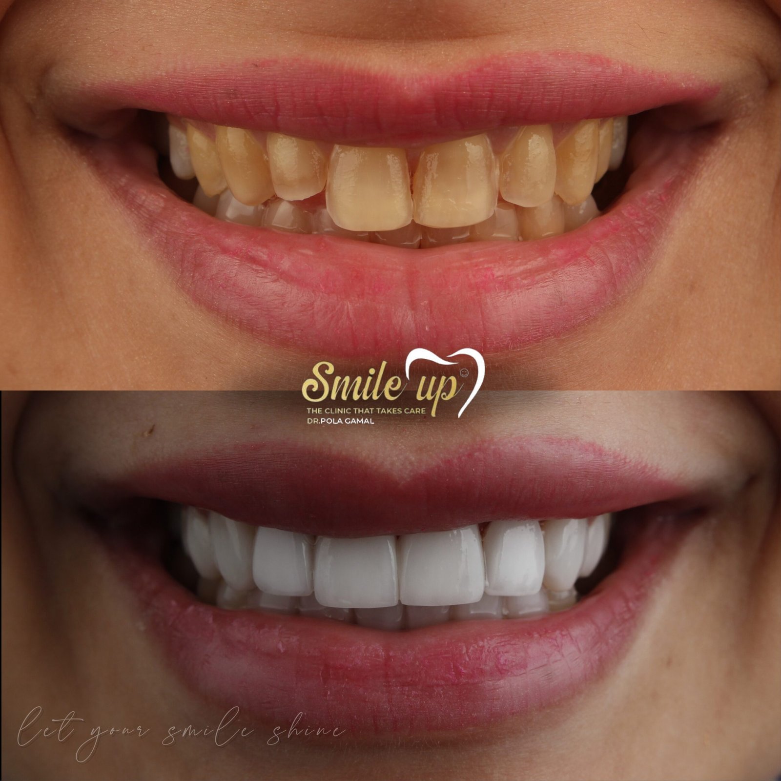 befora and after case 3_20241022_160012_0000