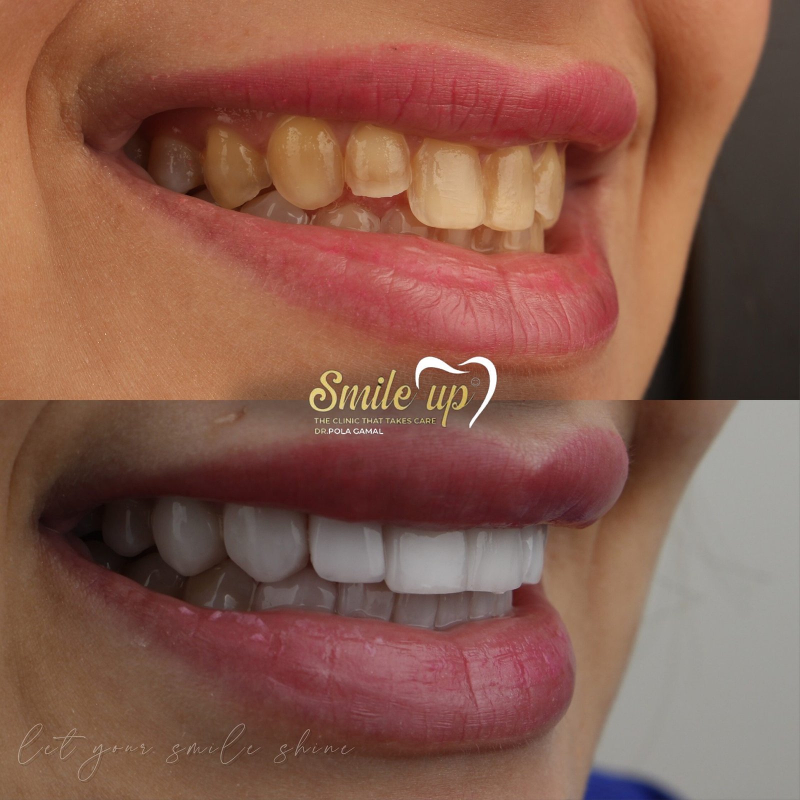 befora and after case 3_20241022_160013_0001