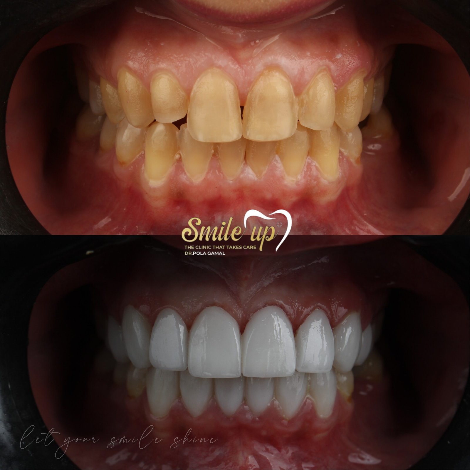 befora and after case 3_20241022_160013_0002