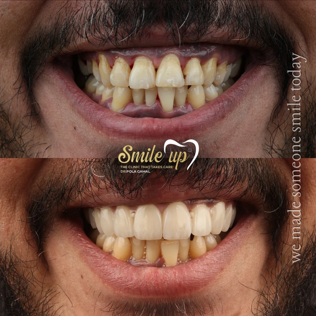 before and after cases_20241022_160300_0006