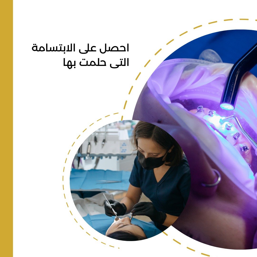 التقويم الشفاف بالقاهرة مع سمايل اب