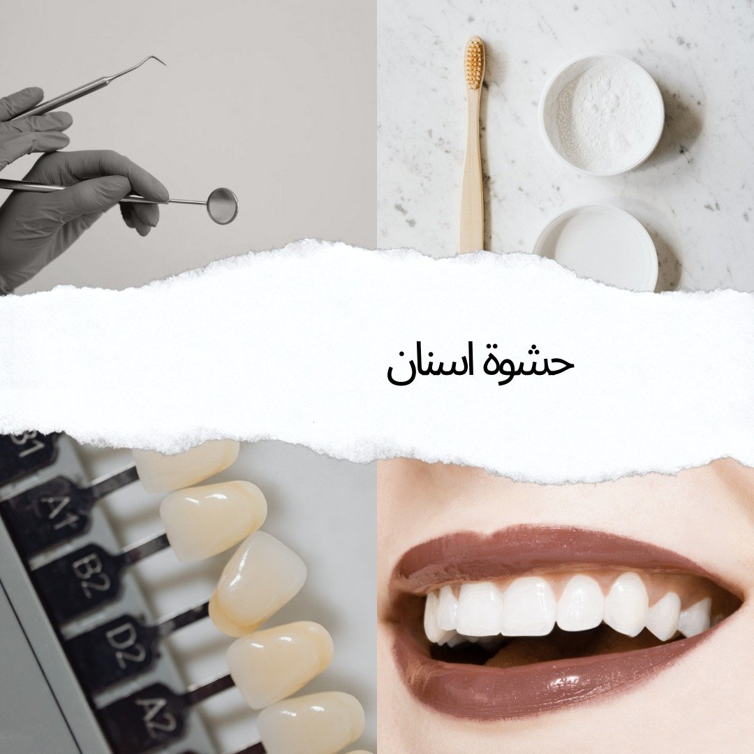 افضل عيادة حشو اسنان بالقاهرة