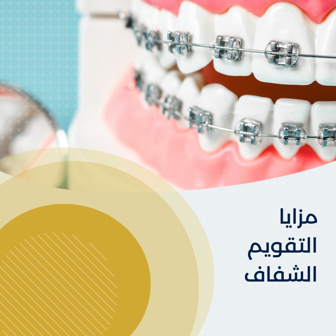 التقويم الشفاف