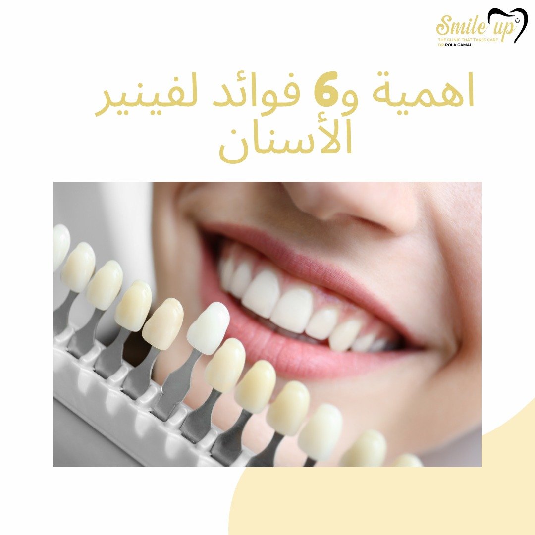 ماهو الفينير و ماهو الفرق بين الفينير والزركون 