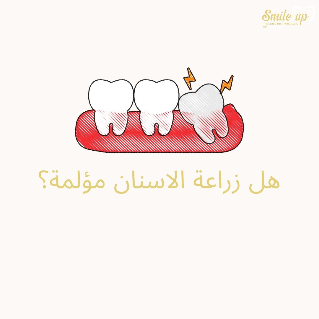 هل زراعة الاسنان مؤلمة