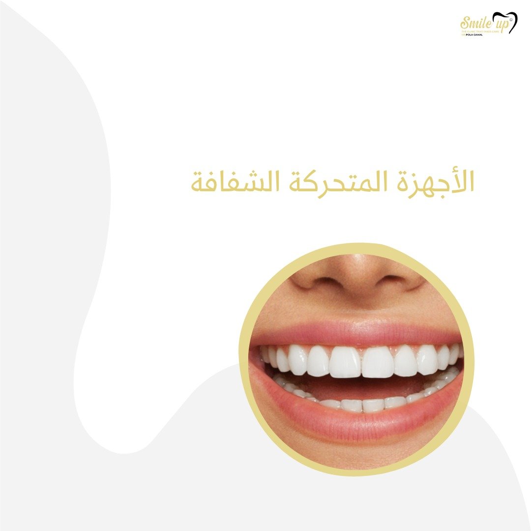 الأجهزة المتحركة الشفافة