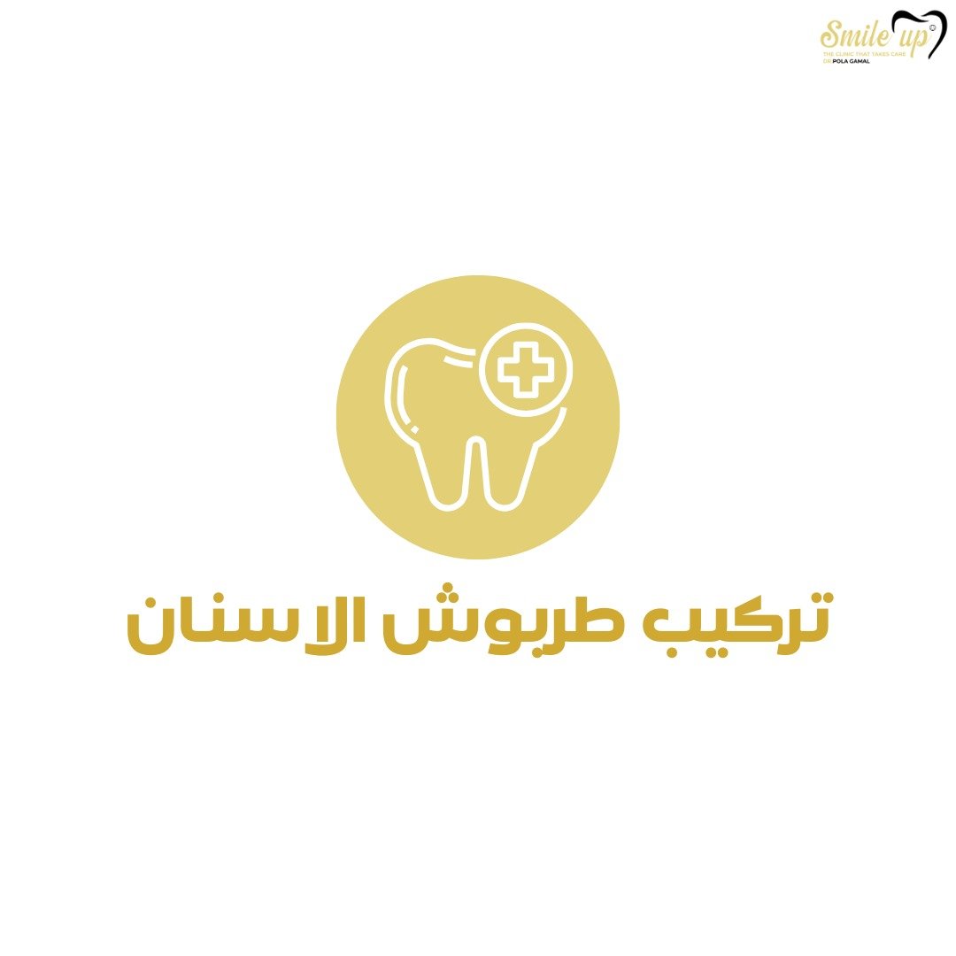 تركيب طربوش الاسنان