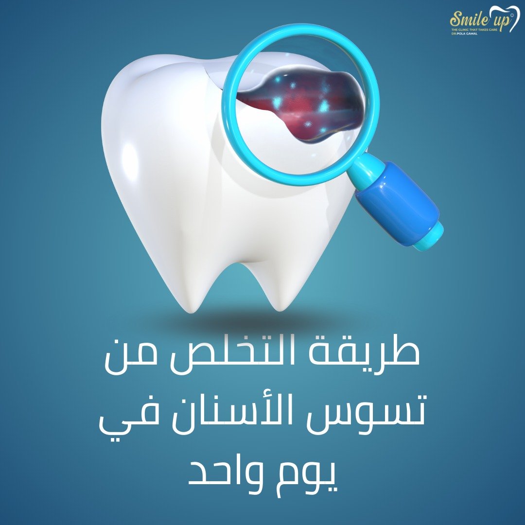 اسباب تسوس الأسنان وطرق الحماية منها