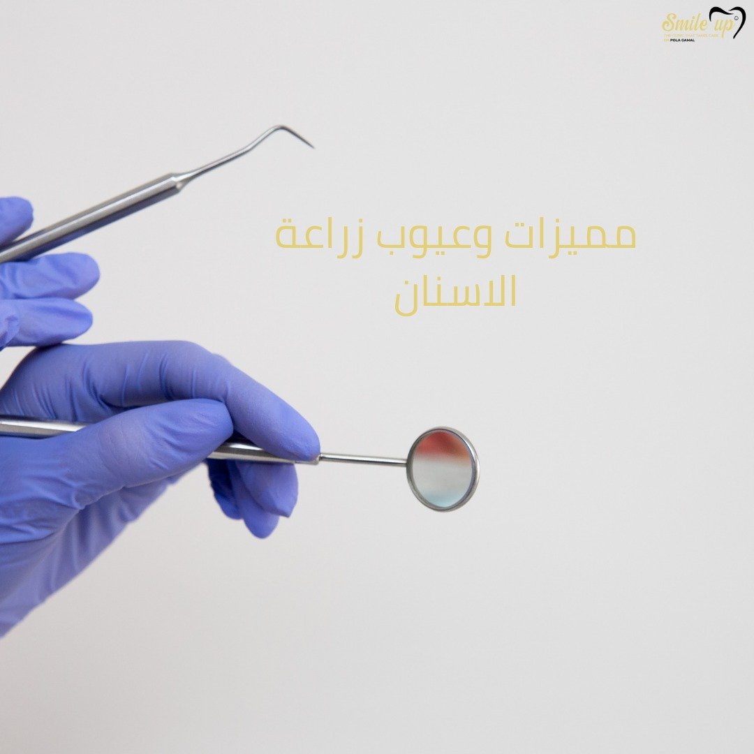 عيوب زراعة الأسنان ومميزاتها مع عيادات سمايل اب