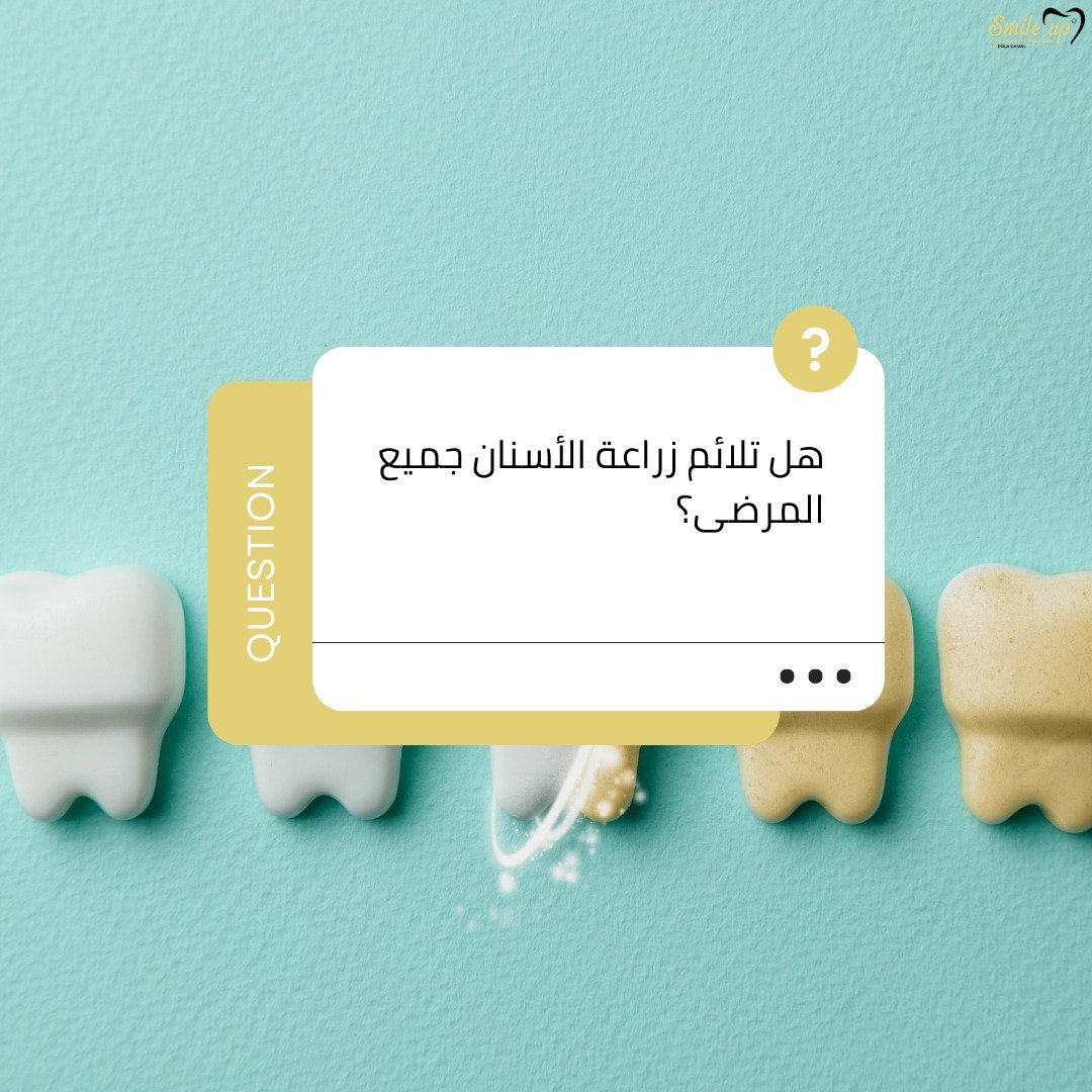 هل تلائم زراعة الأسنان جميع المرضى؟