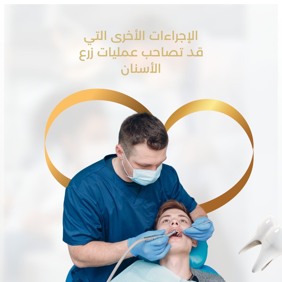 الإجراءات الأخرى التي قد تصاحب عمليات زرع الأسنان