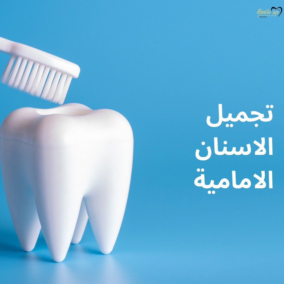 هل يمكن تجميل الأسنان الأمامية بدون تقويم ؟